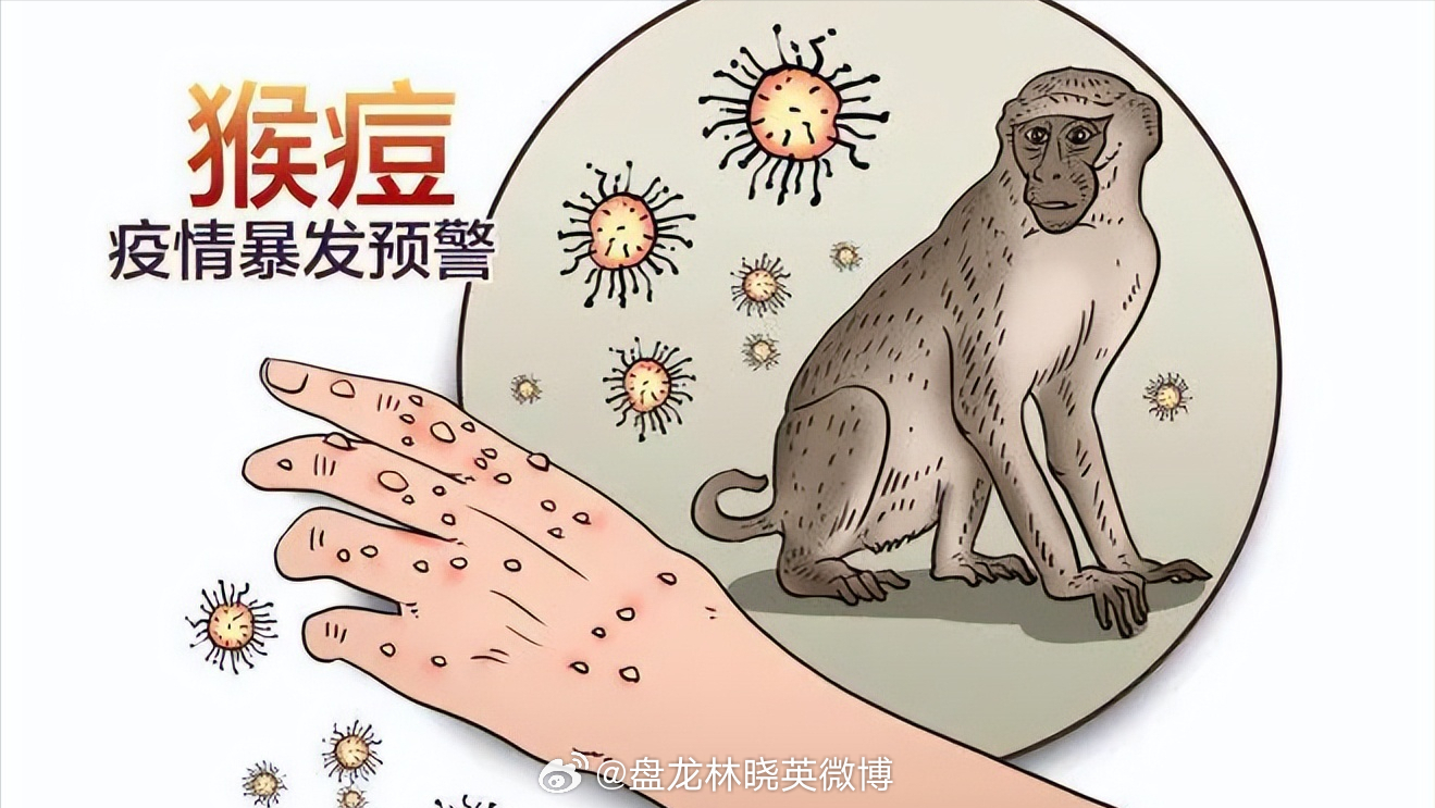 猴痘疫情最新消息,猴痘疫情最新消息,全球防控形势与应对策略