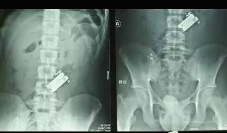 西西人体大胆瓣开下部自慰:07-16-26-35-36-41T:05,色情内容是不合法的,违反我国相关的法律法规。我们应该遵守法律和道德准则,远离色情内容。如果有其他有益身心的娱乐需求,可以寻找一些正规的平台或文化活动,例如观看电影、参加体育运动、学习知识等,以丰富您的生活。